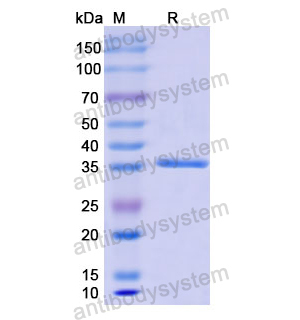 重組KRT13蛋白,Recombinant Human KRT13, N-His