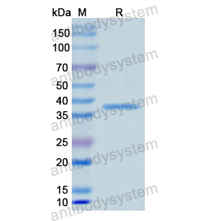 重组KRT5蛋白,Recombinant Human KRT5, N-His