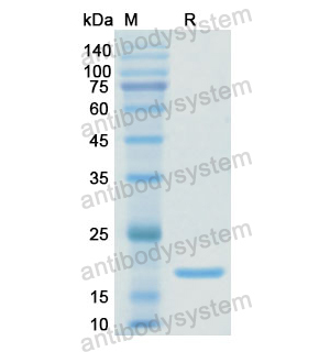 重组PDIA4蛋白,Recombinant Human PDIA4, N-His