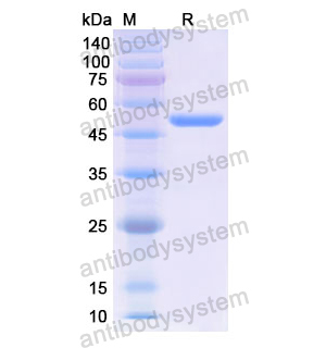 重組ACP5蛋白,Recombinant Human ACP5, N-GST