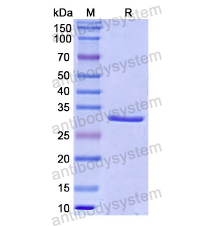 重组CD142/F3/TF蛋白,Recombinant Human CD142/F3/TF, N-His