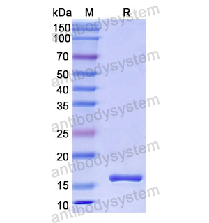 重组PRG2/MBP蛋白,Recombinant Human PRG2/MBP, N-His