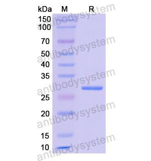 重组ETFA蛋白,Recombinant Human ETFA, N-His