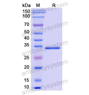 重組TNNT1蛋白,Recombinant Human TNNT1, N-His