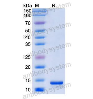 重组MIF/GIF蛋白,Recombinant Human MIF/GIF, N-His