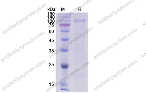 重组HGF蛋白,Recombinant Human HGF, C-His