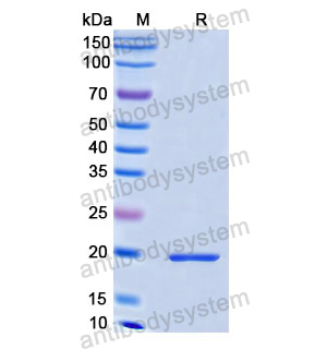 重组DRD2蛋白,Recombinant Human DRD2, N-His