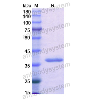 重組ACYP2蛋白,Recombinant Human ACYP2, N-GST