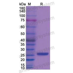 重组CKMT1A蛋白,Recombinant Human CKMT1A, N-His