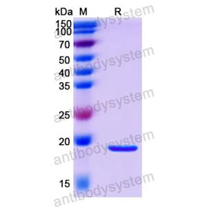 重组COX4/COX4I1蛋白,Recombinant Human COX4/COX4I1, N-His