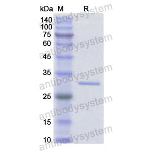 Recombinant Human IFI30, N-His