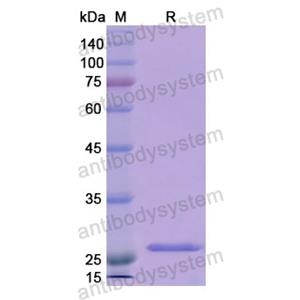 Recombinant Human RNH1, N-His