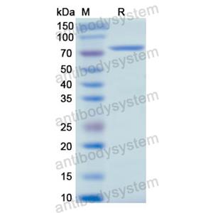 重组SCG2蛋白,Recombinant Human SCG2, N-His