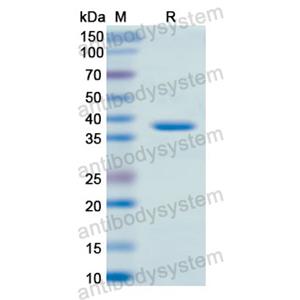 重組CD56/NCAM1蛋白,Recombinant Human CD56/NCAM1, N-His