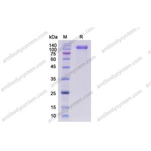 Recombinant Human CD56/NCAM1, C-His