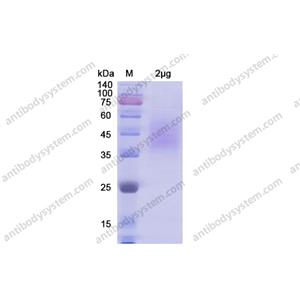 重組CD102/ICAM2蛋白,Recombinant Human CD102/ICAM2, C-His