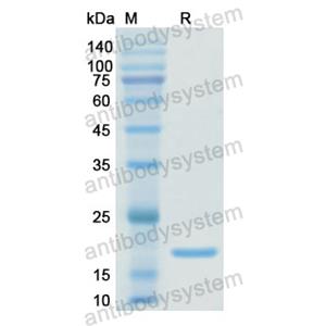 重组PDIA4蛋白,Recombinant Human PDIA4, N-His