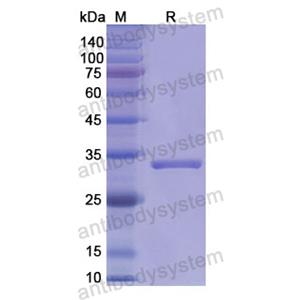 重组CD66a/CEACAM1蛋白,Recombinant Human CD66a/CEACAM1, N-His