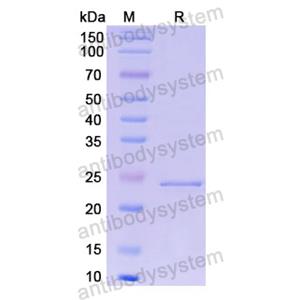 重组OSM/Oncostatin-M蛋白,Recombinant Human OSM/Oncostatin-M, N-His