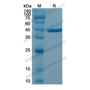 重组HSP90B1蛋白,Recombinant Human HSP90B1, N-His
