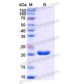 重組MYL6B蛋白,Recombinant Human MYL6B, N-His