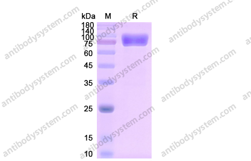 重組CD121a/IL1R1蛋白,Recombinant Human CD121a/IL1R1, C-Fc