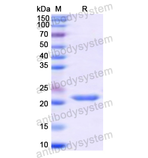 重組MMP9蛋白,Recombinant Human MMP9, N-His