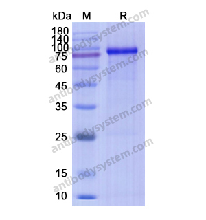 重組MMP9蛋白,Recombinant Human MMP9, C-His