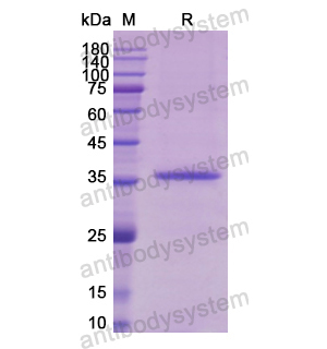 重組MYOD1蛋白,Recombinant Human MYOD1, N-His