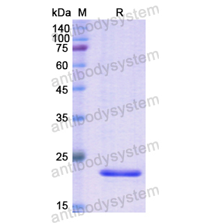 重组ACP3蛋白,Recombinant Human ACP3, N-His