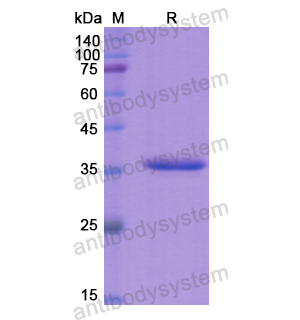 重組EZR蛋白,Recombinant Human EZR, N-His