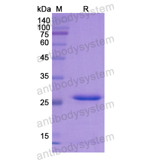 重組FOLR1蛋白,Recombinant Human FOLR1, N-His