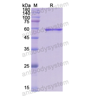 重组VAV1蛋白,Recombinant Human VAV1, N-GST