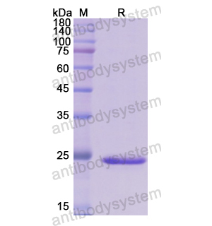 重组ELN蛋白,Recombinant Human ELN, N-His