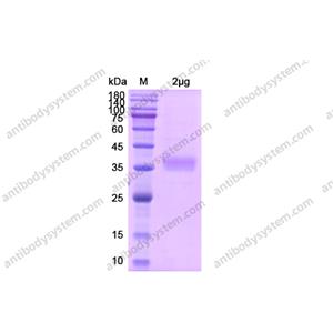 Recombinant Human CD122/IL2RB, C-His