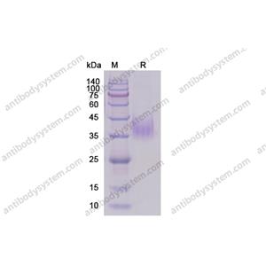 重组CD119/IFNGR1蛋白,Recombinant Human CD119/IFNGR1, C-His