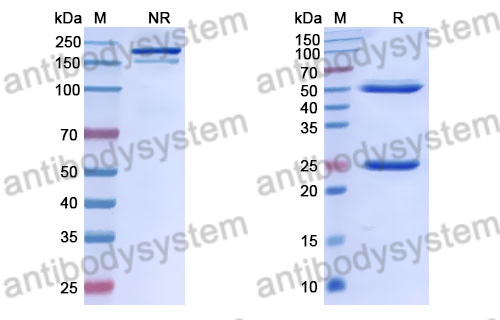 Anti-DOTA (metal-bound) Antibody (2D12.5) (RGN38301),Anti-DOTA (metal-bound) Antibody (2D12.5) (RGN38301)