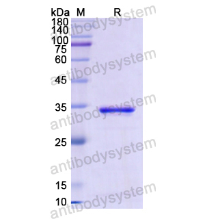重组CD46蛋白,Recombinant Human CD46, N-His