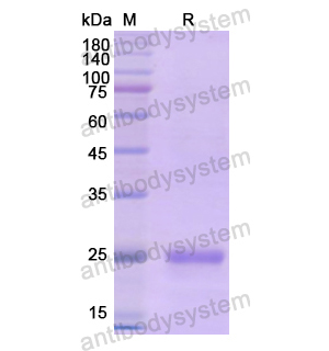 重組DSP蛋白,Recombinant Human DSP, N-His