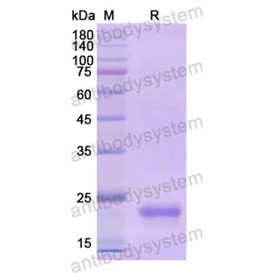 重组CD179b/IGLL1蛋白,Recombinant Human CD179b/IGLL1, N-His