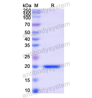 重组CD62P/SELP蛋白,Recombinant Human CD62P/SELP, N-His