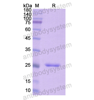 重组CD43/SPN,蛋白,Recombinant Human CD43/SPN, N-His
