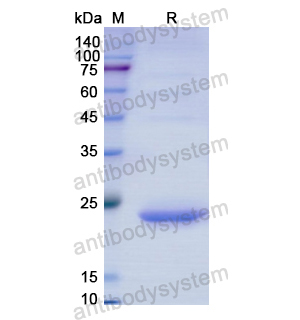 重组ACADS蛋白,Recombinant Human ACADS, N-His