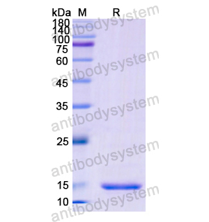 重组CD152/CTLA4蛋白,Recombinant Human CD152/CTLA4, N-His