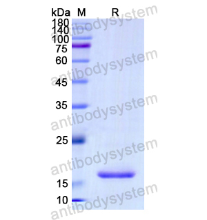 重组PCSK2蛋白,Recombinant Human PCSK2, N-His