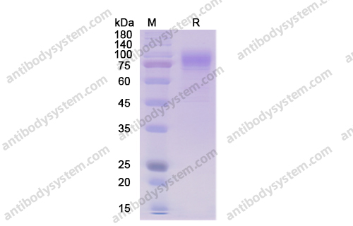 重組CD36蛋白,Recombinant Human CD36, C-His