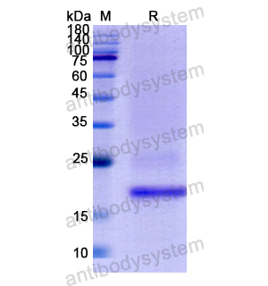 重組FAH蛋白,Recombinant Human FAH, N-His