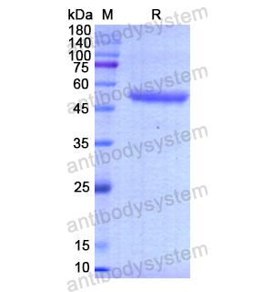 重组RHOQ蛋白,Recombinant Human RHOQ, N-GST