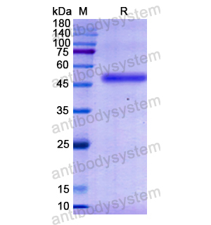 重组GOT1蛋白,Recombinant Human GOT1, N-His