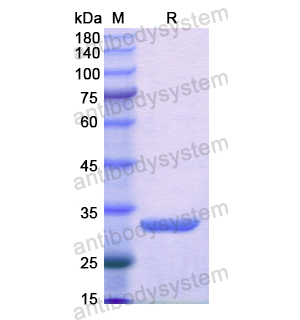 重组AKR1C4蛋白,Recombinant Human SMPD1, N-His